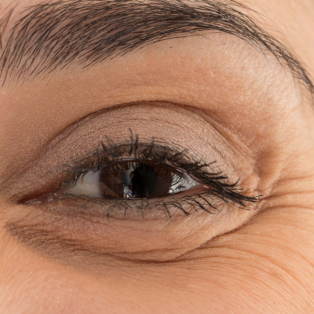 Blepharoplasty Eyelid Surgery Toronto Dr Philip Solomon