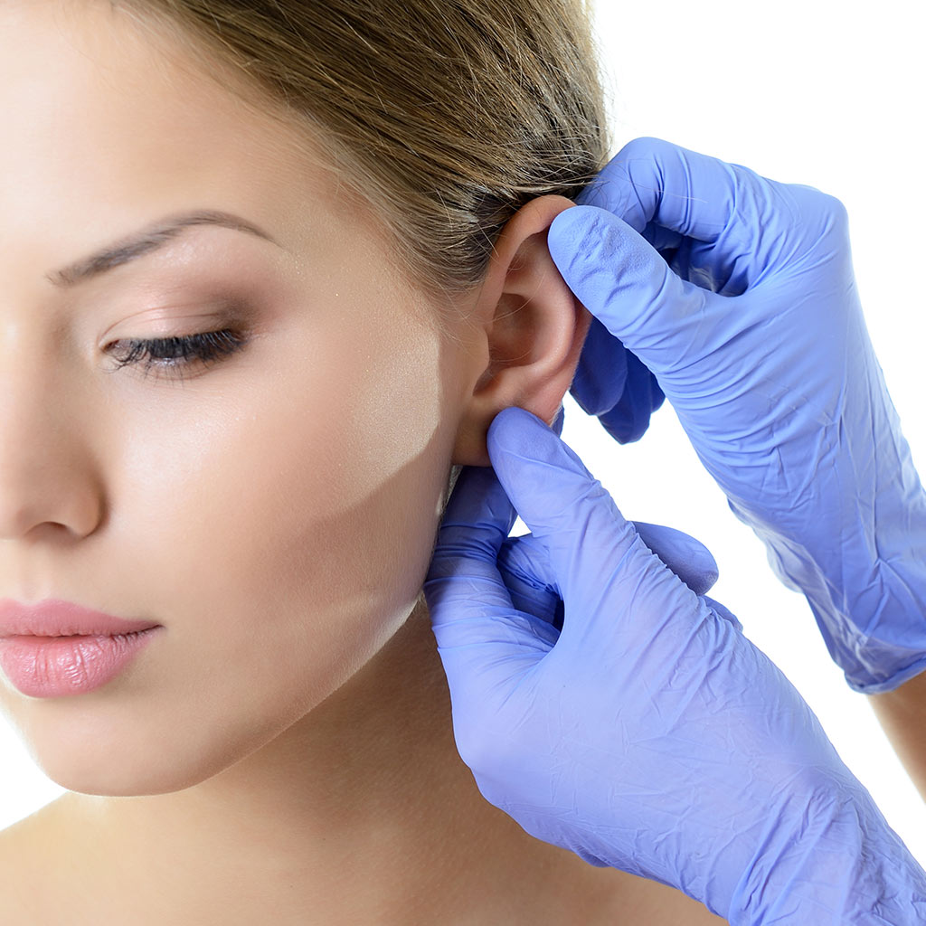 Otoplasty Surgery Otoplasty Surgery