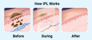 How IPL Works