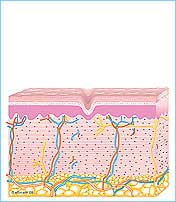 Wrinkle with Pellevé System
