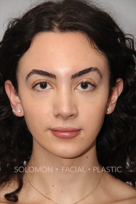 Transgender Before After Photos