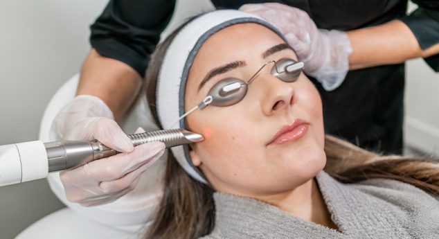 Ultrapulse CO2 Deep Laser Resurfacing With Erbium