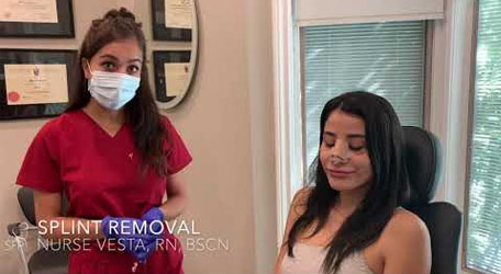 Splint Removal After Nose Job Surgery | 1 Week Before & After Results | by Dr. Philip Solomon