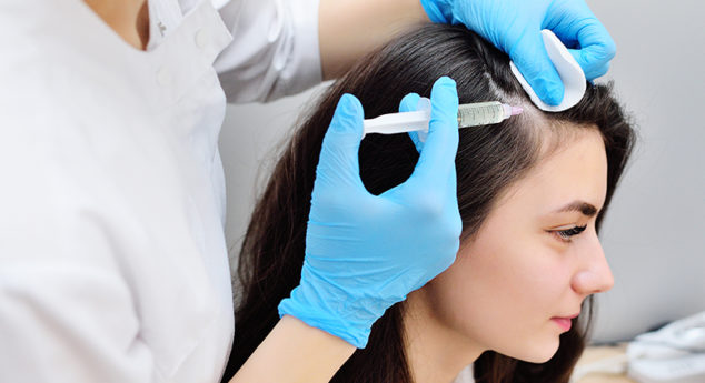 PRP-HAIR-LOSS-TREATMENT