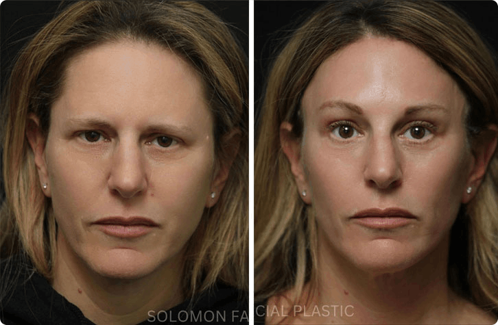 DR. SOLOMON’S COSMETIC SURGERY GALLERY